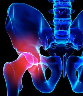 Margaret's story — hip replacement