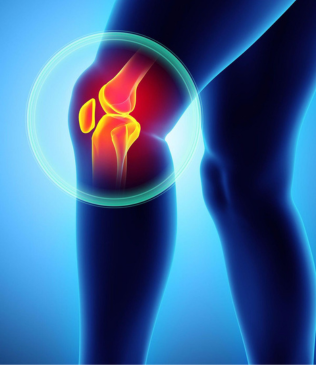 David's story — knee arthroscopy
