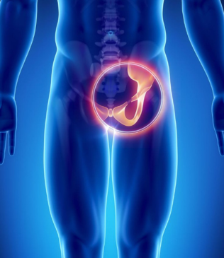 Pelvis and hip planning