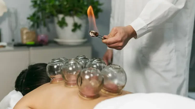 cupping banner cupping banner