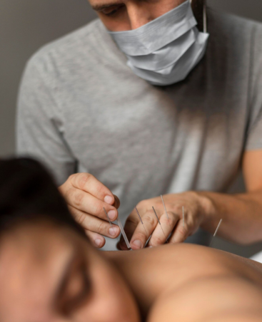 Acupuncture